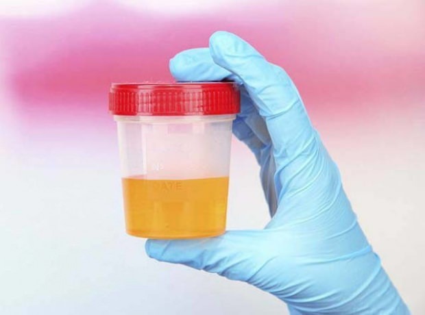 Graviditetstest med urin