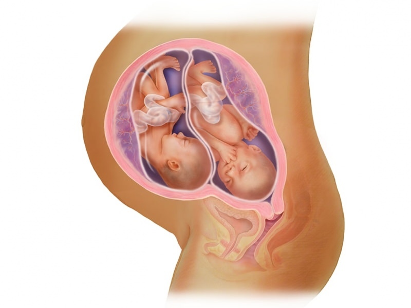 Twin graviditet i IVF! Hvad er embryooverførsel?