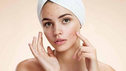 Er acne piller skadelige?