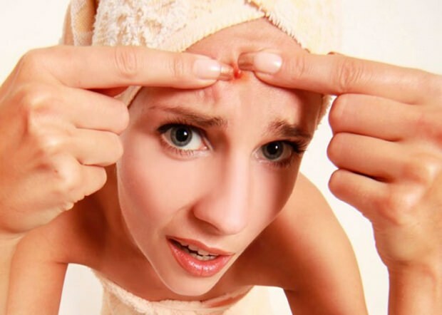 Er acne årsag til hovedpine? Hvad skal man gøre mod smertefuld acne? Smerter fra acne ...