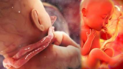 Hvad er en ledningsforvikling? Ledningsforviklinger omkring babyens hals i mors liv