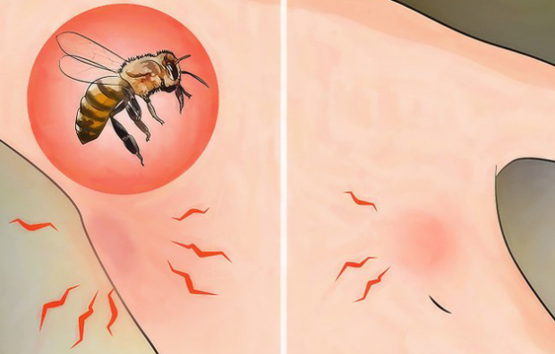 Hvad er bierallergi, og hvad er symptomerne? Naturlige metoder, der er gode til bi-stings