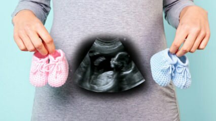 Vil babyens køn blive bestemt i graviditetens første trimester?