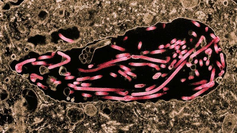 billede af ebolansk spredning til celler