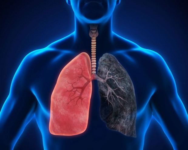 hvad er lungekræft