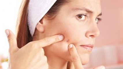 Hvad er acne, der ikke bør kede sig?