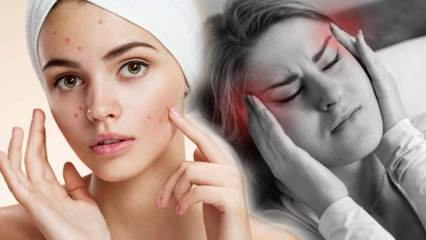 Er acne årsag til hovedpine? Hvad skal man gøre mod smertefulde bumser? Smerter fra acne ...