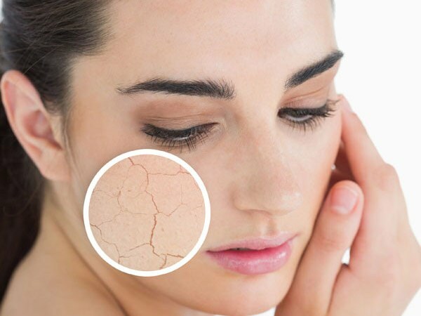 Hvorfor tørrer huden? Hvad skal man gøre på tør hud? De mest effektive plejeanbefalinger til tør hud