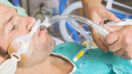 Hvad er den intubation, som Fahrettin Koca sagde? Hvad betyder det at intubere patient? Vil den intuberede patient komme sig?