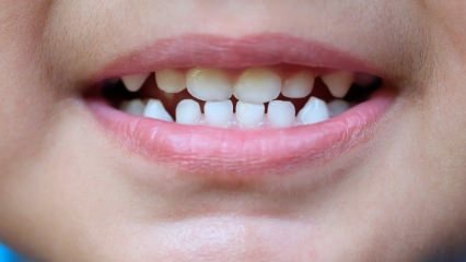 Hvordan underviser børn tandpleje?
