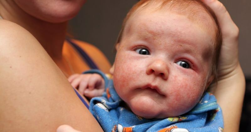 Årsager til rødme i øjet hos spædbørn