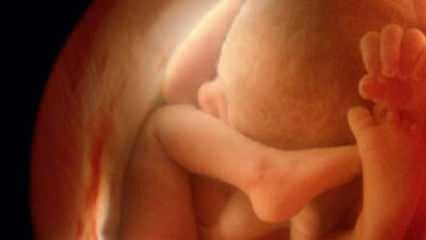 Viser ikke babyens køn ved ultralyd! Hvordan ser baby drenge og piger ud på ultralyd?