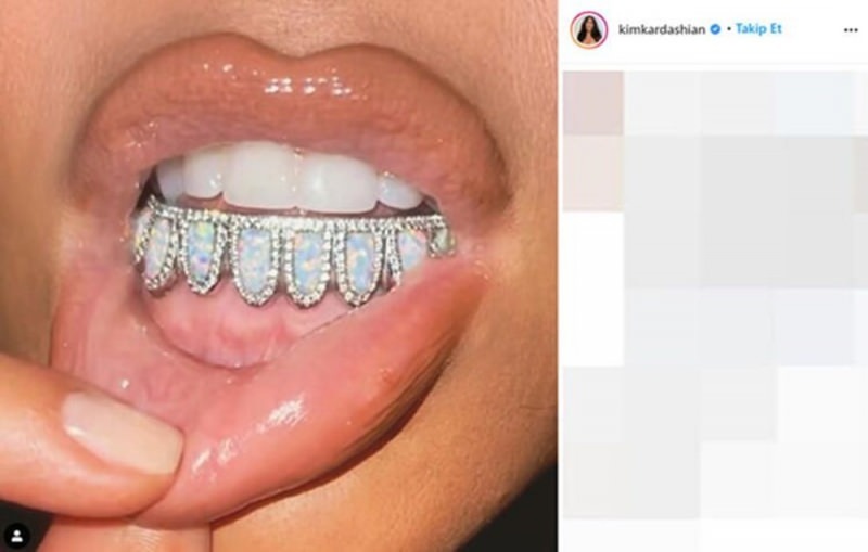 Kim Kardashians tandpleje på $ 5.000