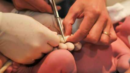 Hvornår skæres navlestrengen hos babyer? Fordele ved at skære navlestrengen sent