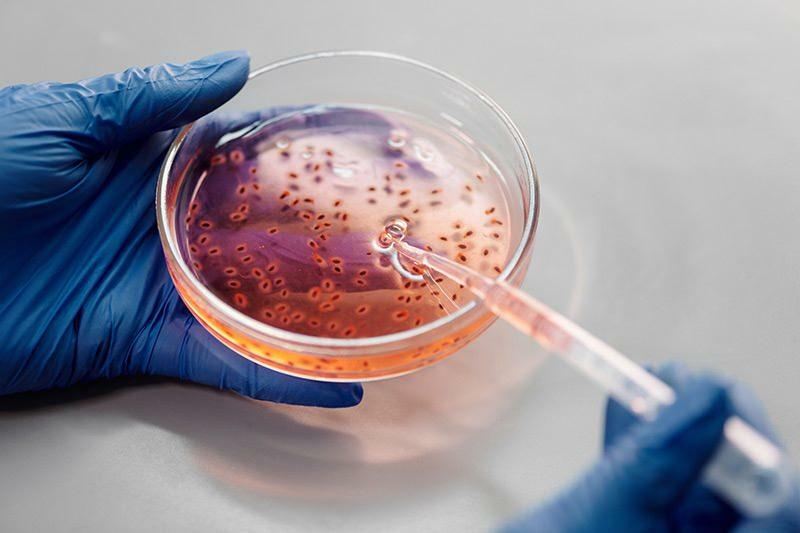 Hvad er symptomerne på oxidativt stress