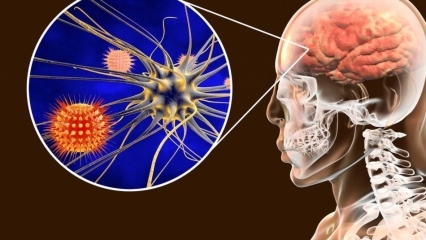 Hvad er meningitis, og hvad er symptomerne? Er der en behandling af meningitis?