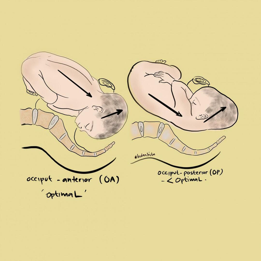 nakkeknude anterior holdning og nakkeknude posterior