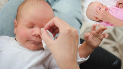 Hvordan fjernes grater hos babyer? Forårsager øjenbrænding hos babyer? Burr massage med modermælk