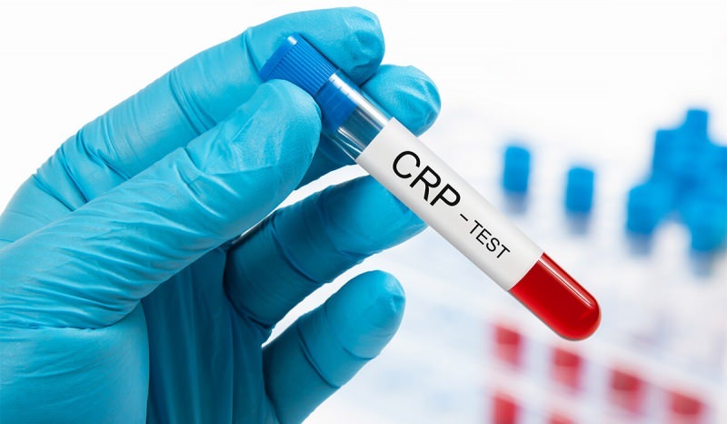 Hvorfor stiger CRP i blodet? Hvad er CRP? Hvordan sænkes CRP?