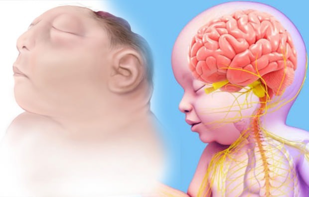 Lever Anencephaly baby? Anencephaly diagnose