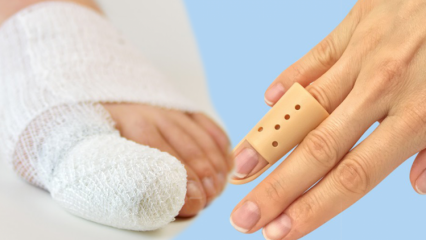Hvad forårsager fingerbrud? Hvad er symptomerne på fingerbrud?