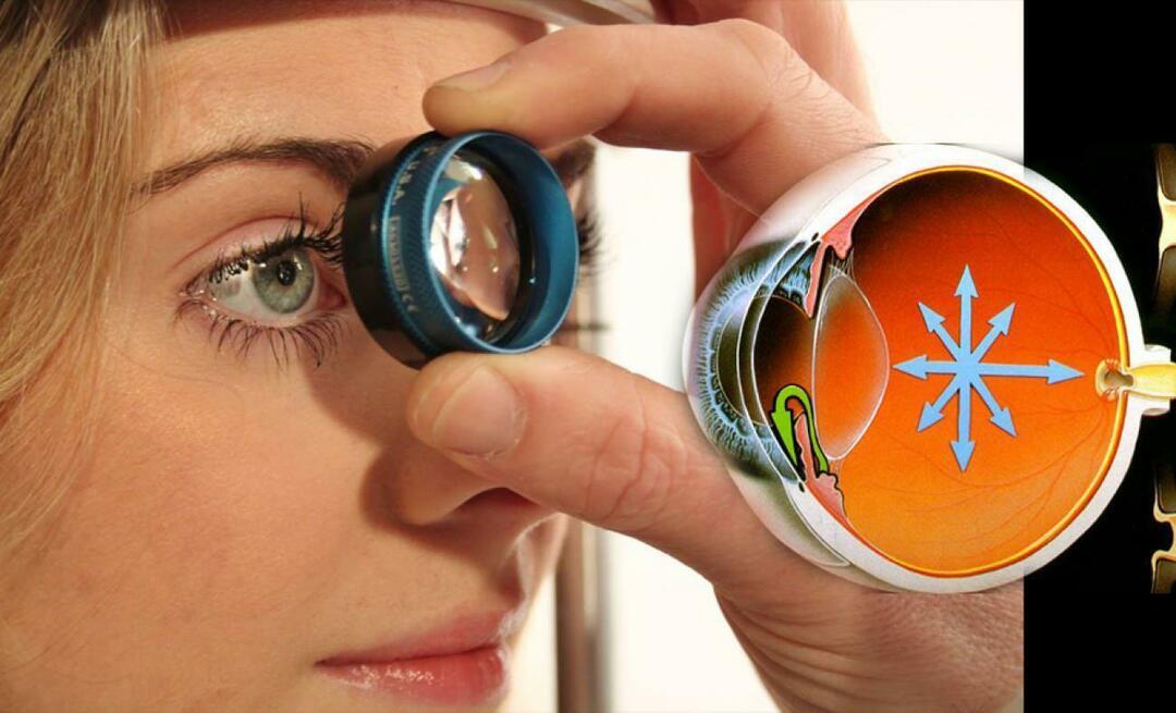 Hvad er glaukom? Vær opmærksom på denne sygdom, der udvikler sig snigende uden at give nogen symptomer!