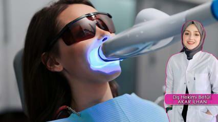 Hvordan udføres tandblegningsmetoden (blegning)? Skader blegemetoden tænderne?