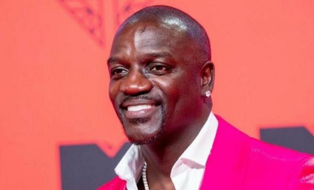 Den amerikanske sangerinde Akon foretrak også Tyrkiet til hårtransplantation! Her er prisen han betalte...