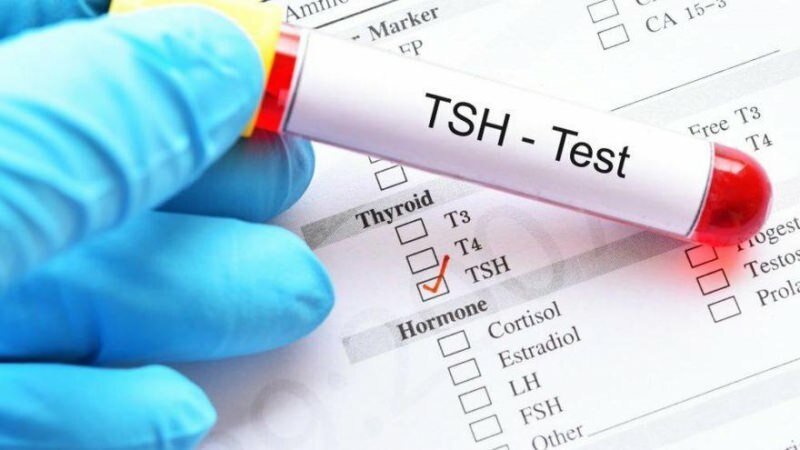 tsh test er en hormon test