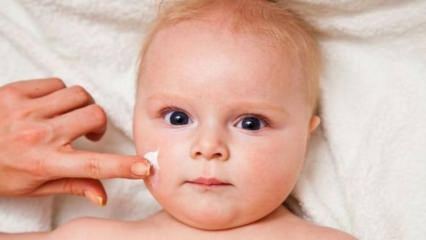 Tips til hudpleje til babyer! Hvad er hudproblemerne hos babyer?