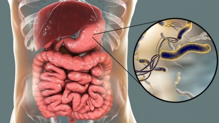 Hvad er Helicobacter Pylori (mave-mikrobe)? Sygdomme forårsaget af Helicobacter Pylori ...