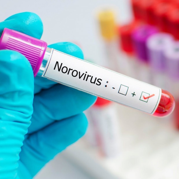 Hvad er norovirus, og hvilke sygdomme forårsager det? Ukendt om Norovirus-infektion ...