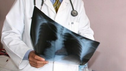 Eksperter annonceret! Forøgelse af dødsfald i lungekræft