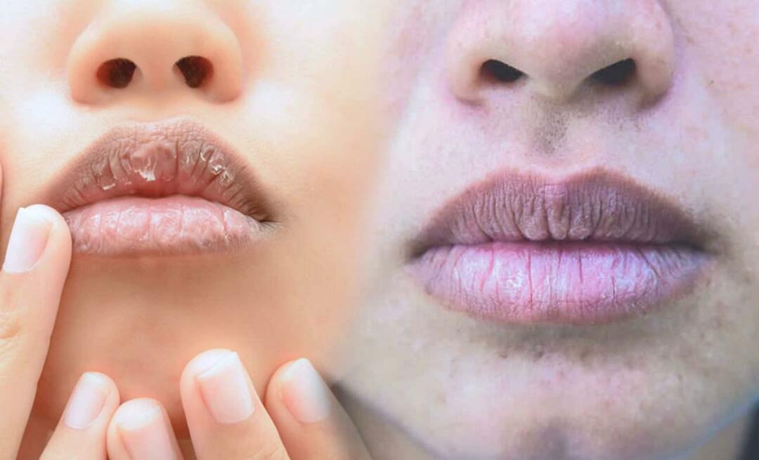 Hvad forårsager mørke læber? Hvordan behandles mørkfarvning af læber eller blå mærker?