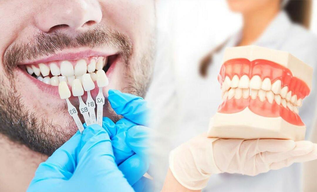 Hvorfor påføres zirkoniumfiner på tænderne? Hvor holdbar er zirkoniumbelægningen?