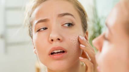 Hvorfor tørrer huden? Hvad skal man gøre på tør hud? De mest effektive plejeanbefalinger til tør hud