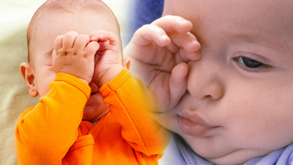 Naturlige løsninger til øjenforbrænding hos babyer