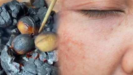 Valnød-olivenolieblanding, der fjerner pletter og brændemærker i dit ansigt!