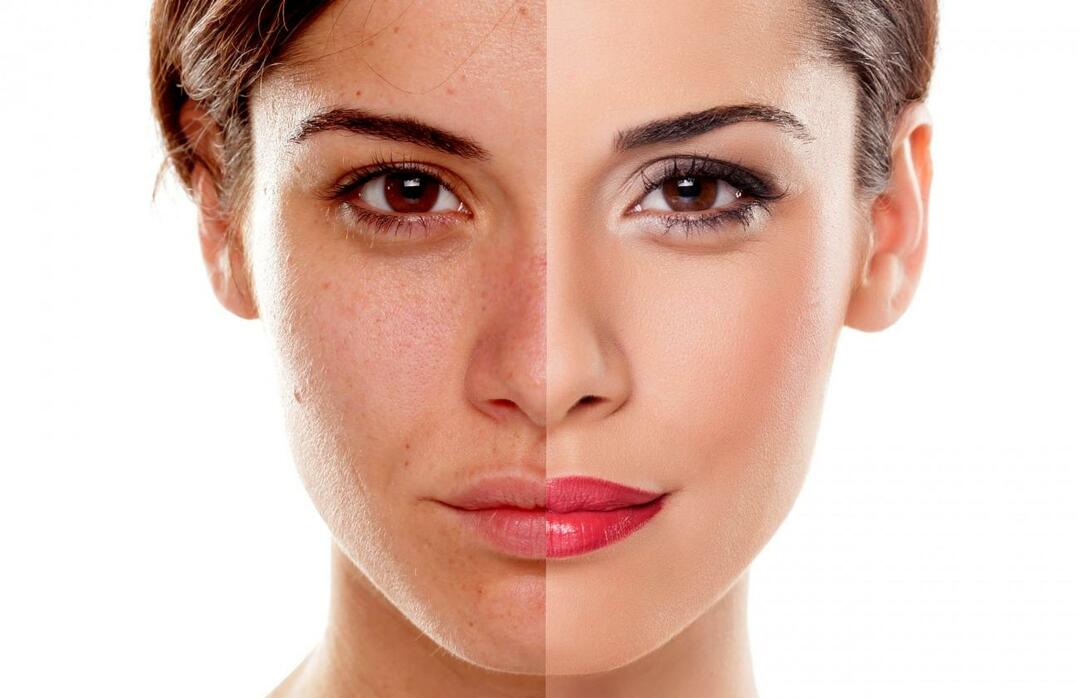 Hvordan forhindrer vi, at huden ser træt ud? Hvordan reducerer man det trætte udseende af huden?