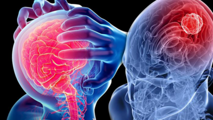 Hvad er cerebellum (rygmarvsgenerering)? Hvad er symptomerne på cerebellum (rygmarv)?