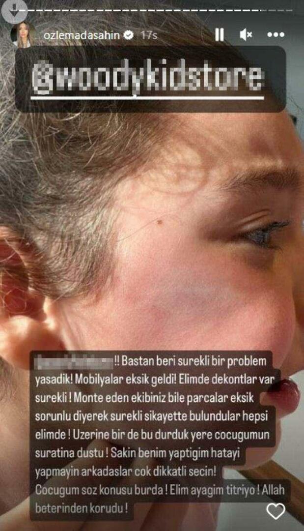 Garderobedøren faldt på Berkay Şahins datters ansigt