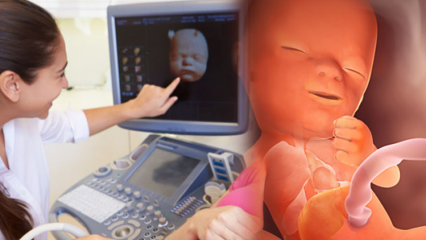 Hvilket organ udvikler sig først hos babyer? Babyudvikling uge for uge