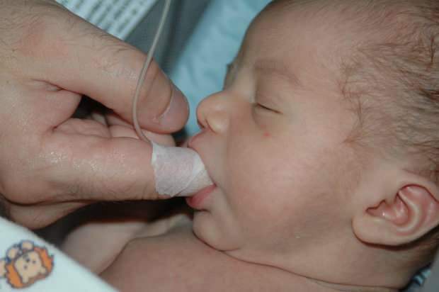 Hvad er metoden Fingerfodring? Hvordan fodres babyen med en sprøjte?