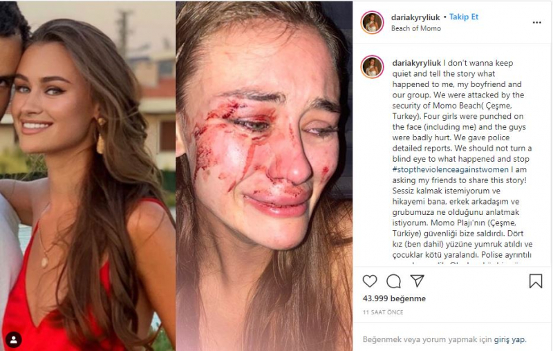 Den ukrainske topmodel Daria Kyryliuk, angiveligt slået i İzmir Çeşme, talte for første gang!