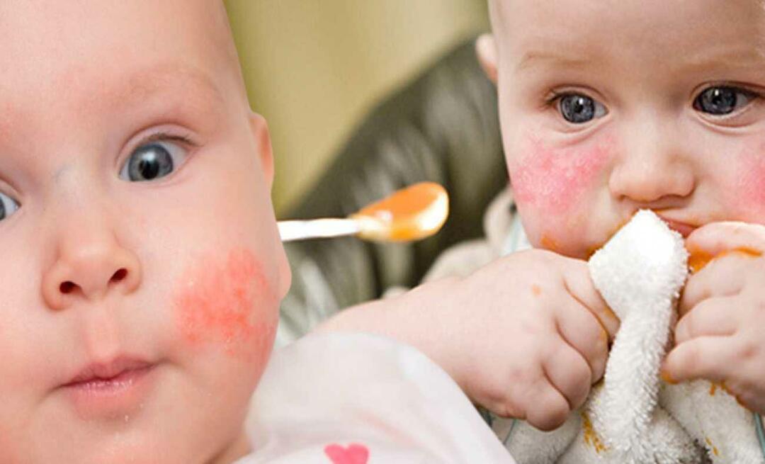 Hvad skal en baby med allergi spise? Hvad er alternative fødevarer til allergiske babyer?