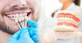 Hvorfor påføres zirkoniumfiner på tænderne? Hvor holdbar er zirkoniumbelægningen?