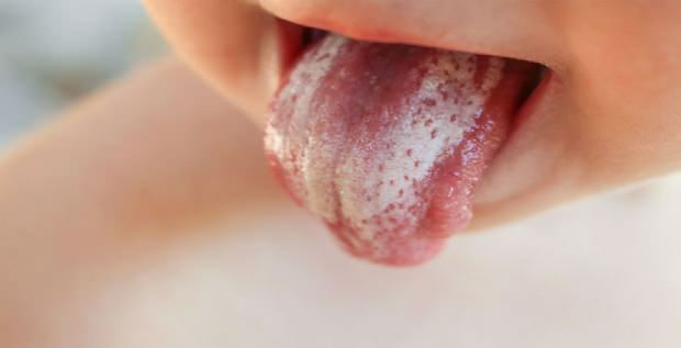 Oral svampebehandling hos spædbørn