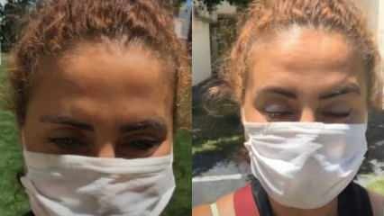 Esra Akkaya, der brugte den samme maske, fik virussen! 