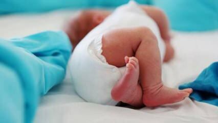 Bør babyer have en hofteultralyd?