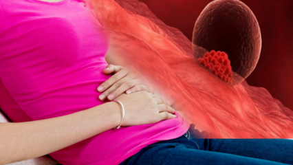 Hvad er implantationsblødning under graviditet? Hvordan man skelner mellem implantationsblødning og menstruationsblødning